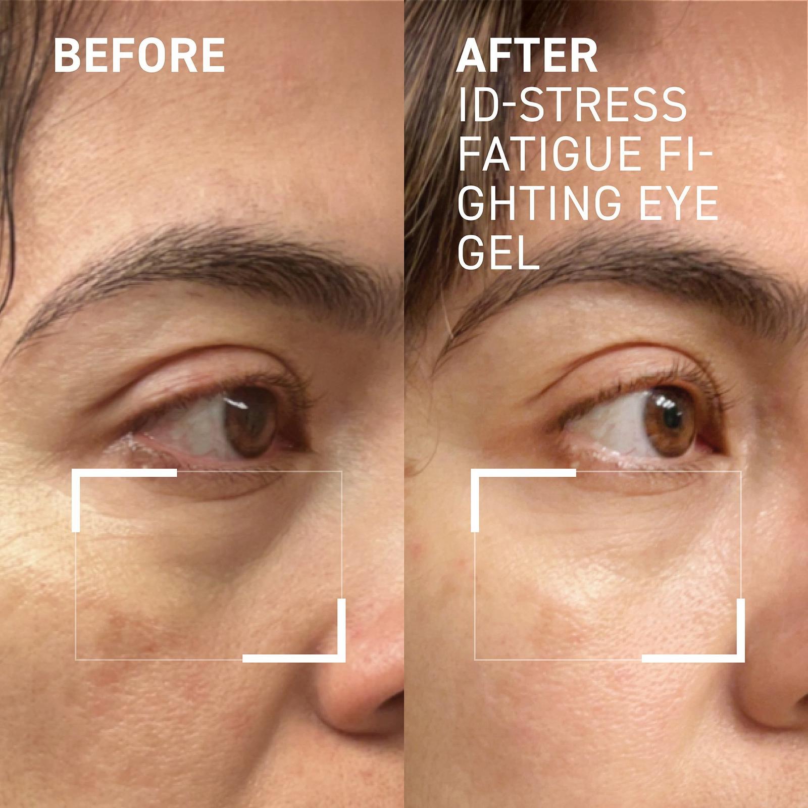 iD-Stress Fatigue Fighting Eye Gel