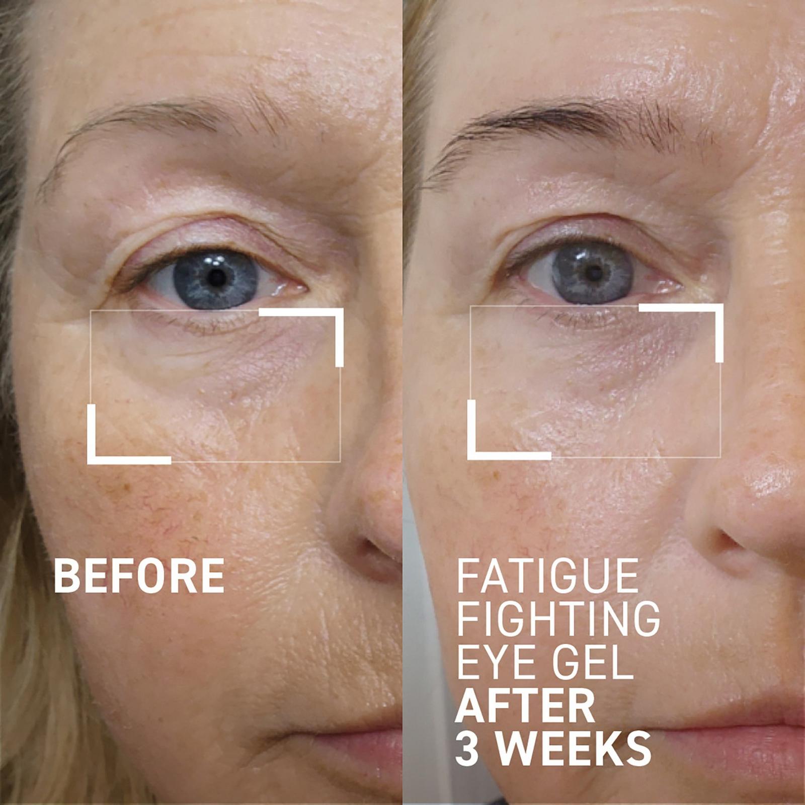 iD-Stress Fatigue Fighting Eye Gel