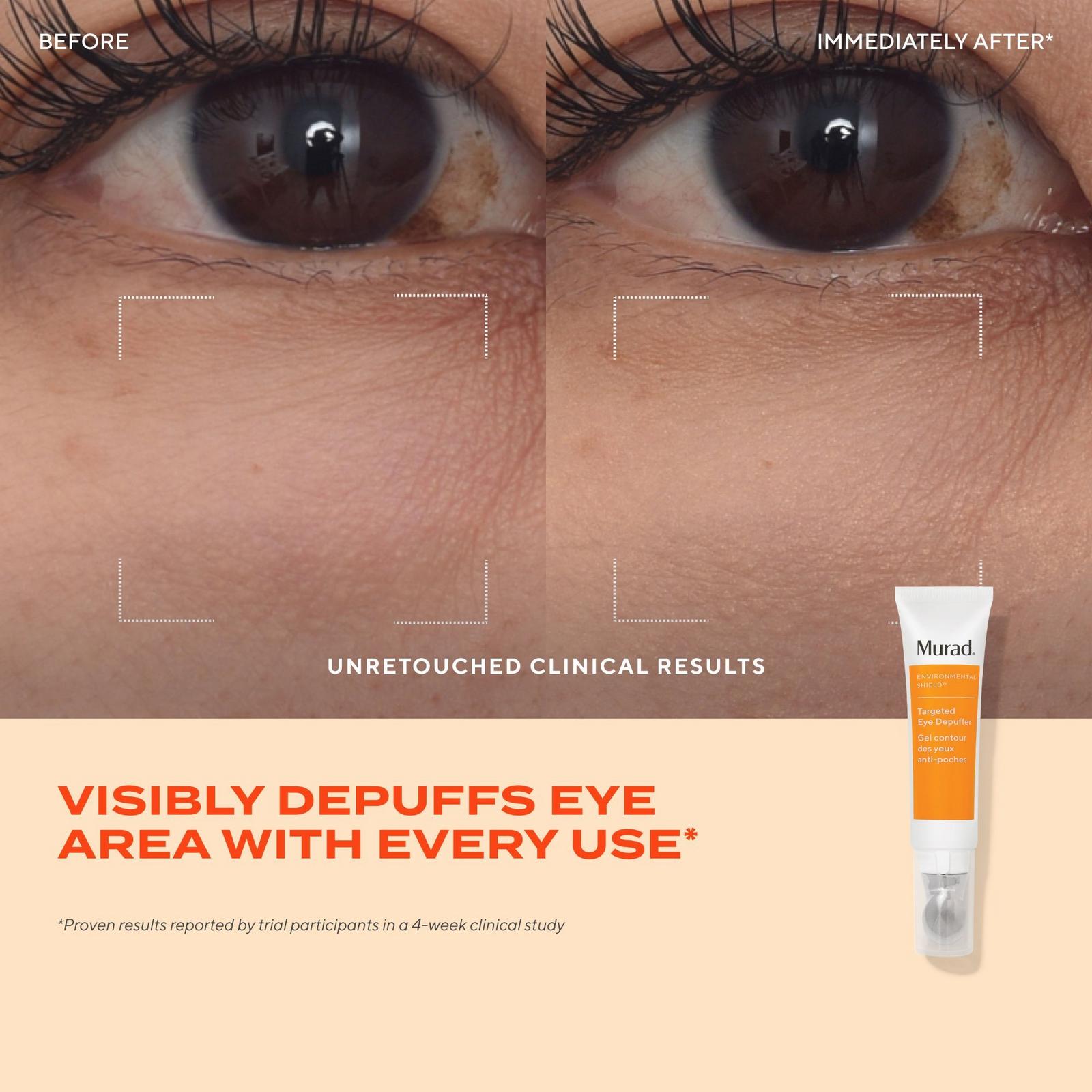 Targeted Eye Depuffer Treatment