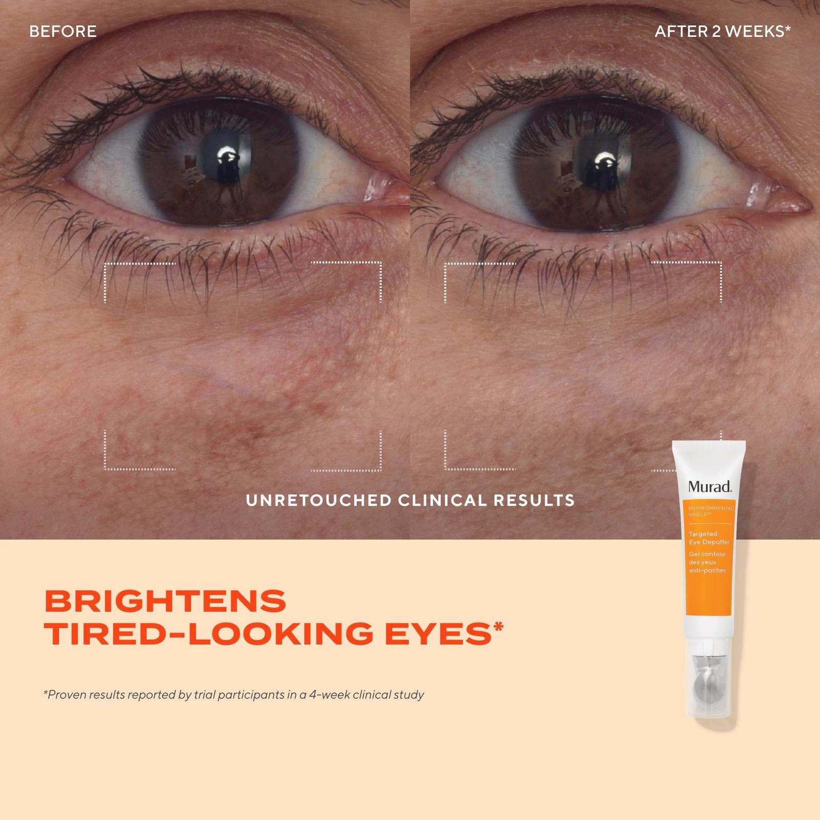 Targeted Eye Depuffer Treatment