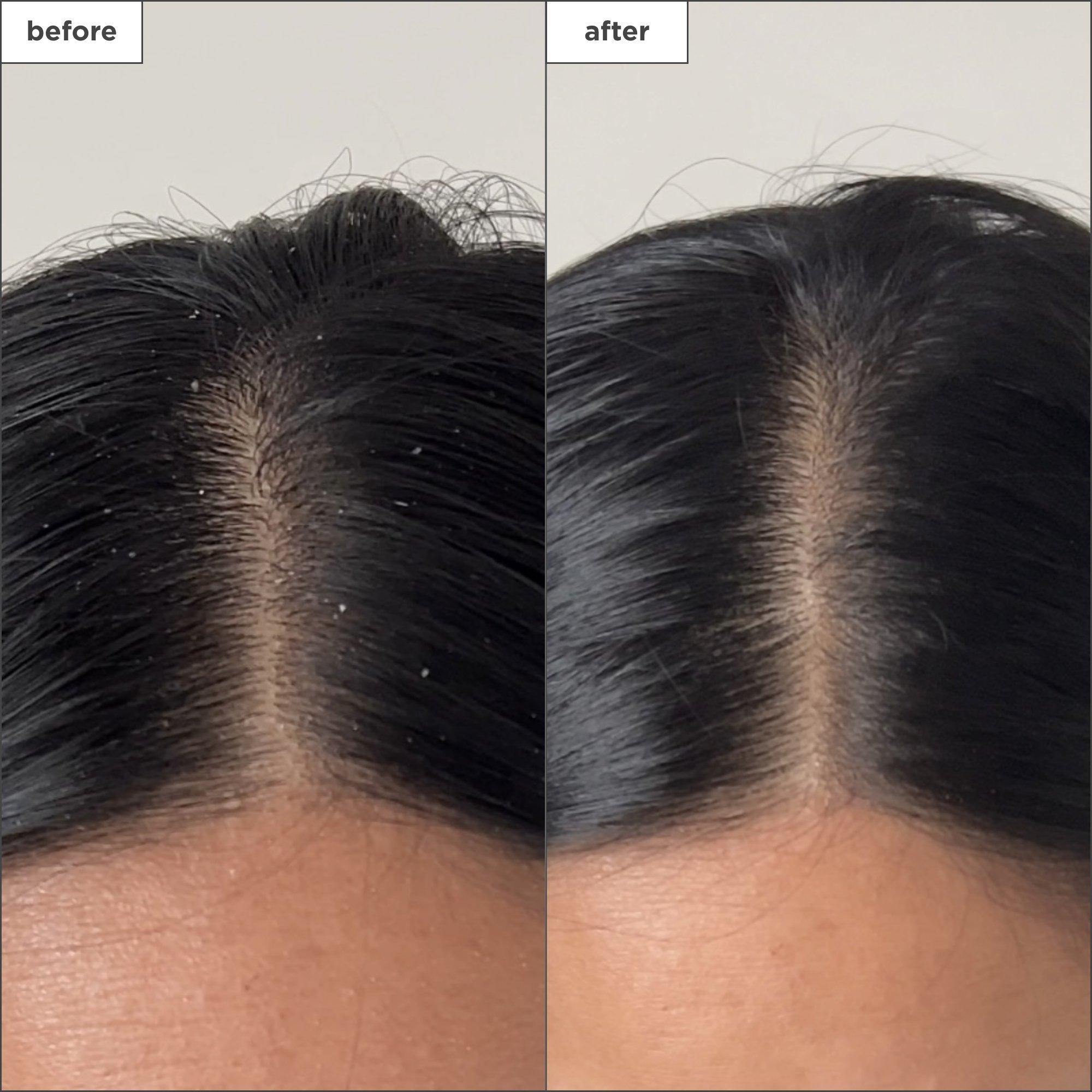Briogeo Scalp Revival Detox Spray - Thumbnail 4