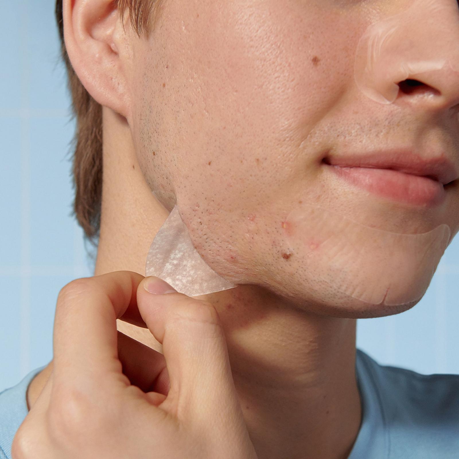 Mighty Patch Face Pore Pimple Patches
