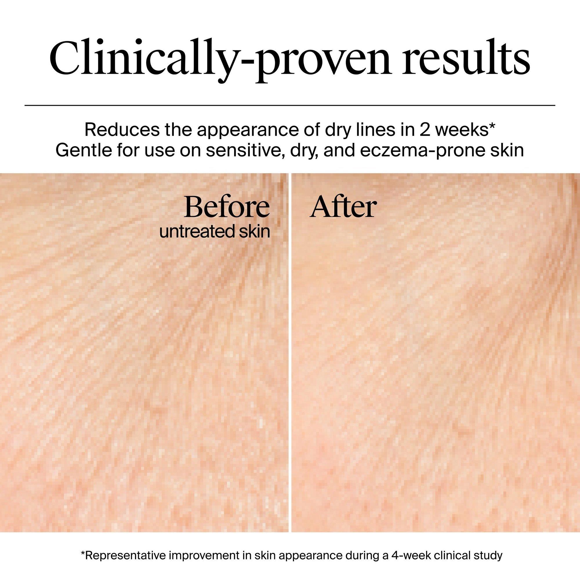 Увлажняющий гель-крем без отдушки Neutrogena Hydro Boost — фото 4