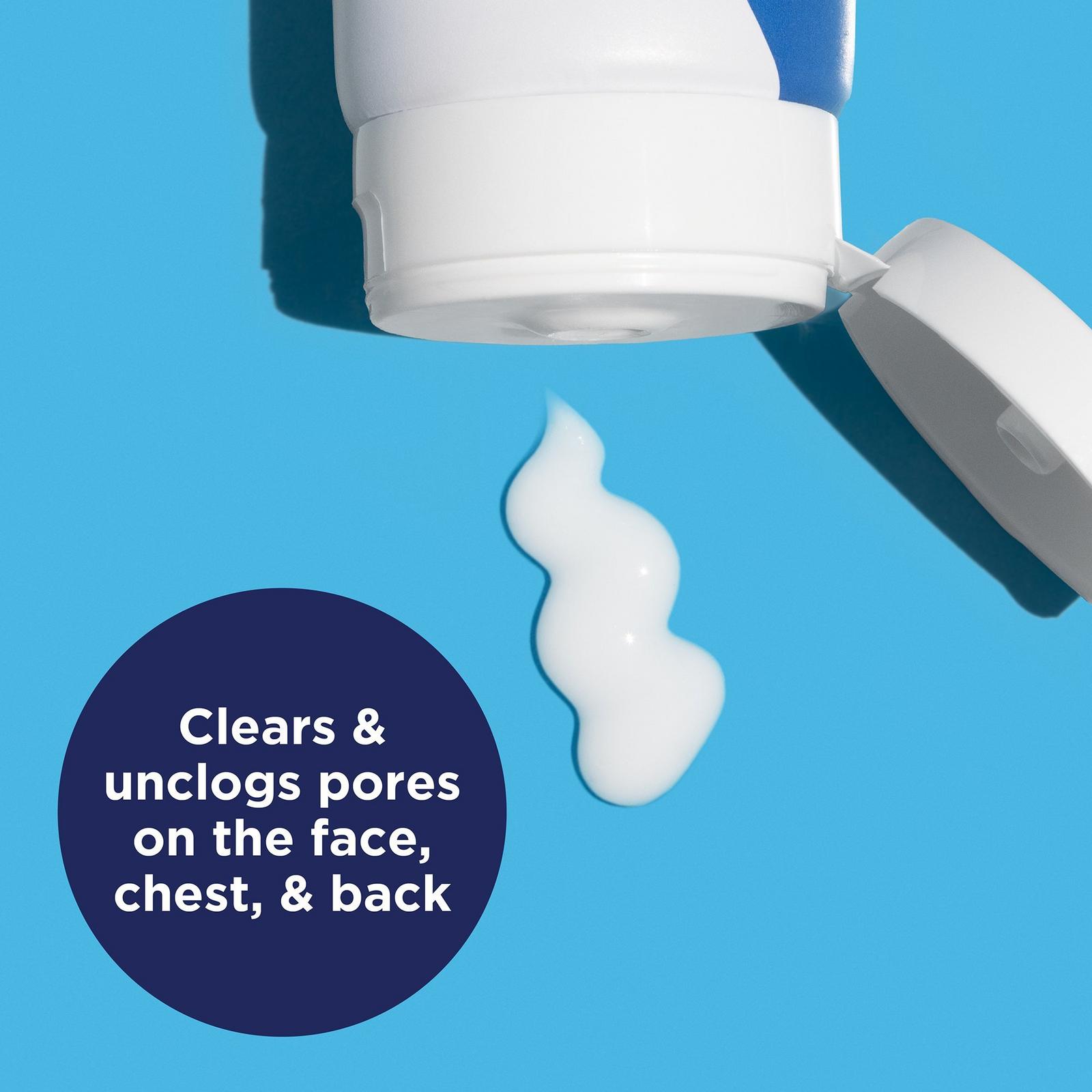 Acne Creamy Wash with 4% Benzoyl Peroxide