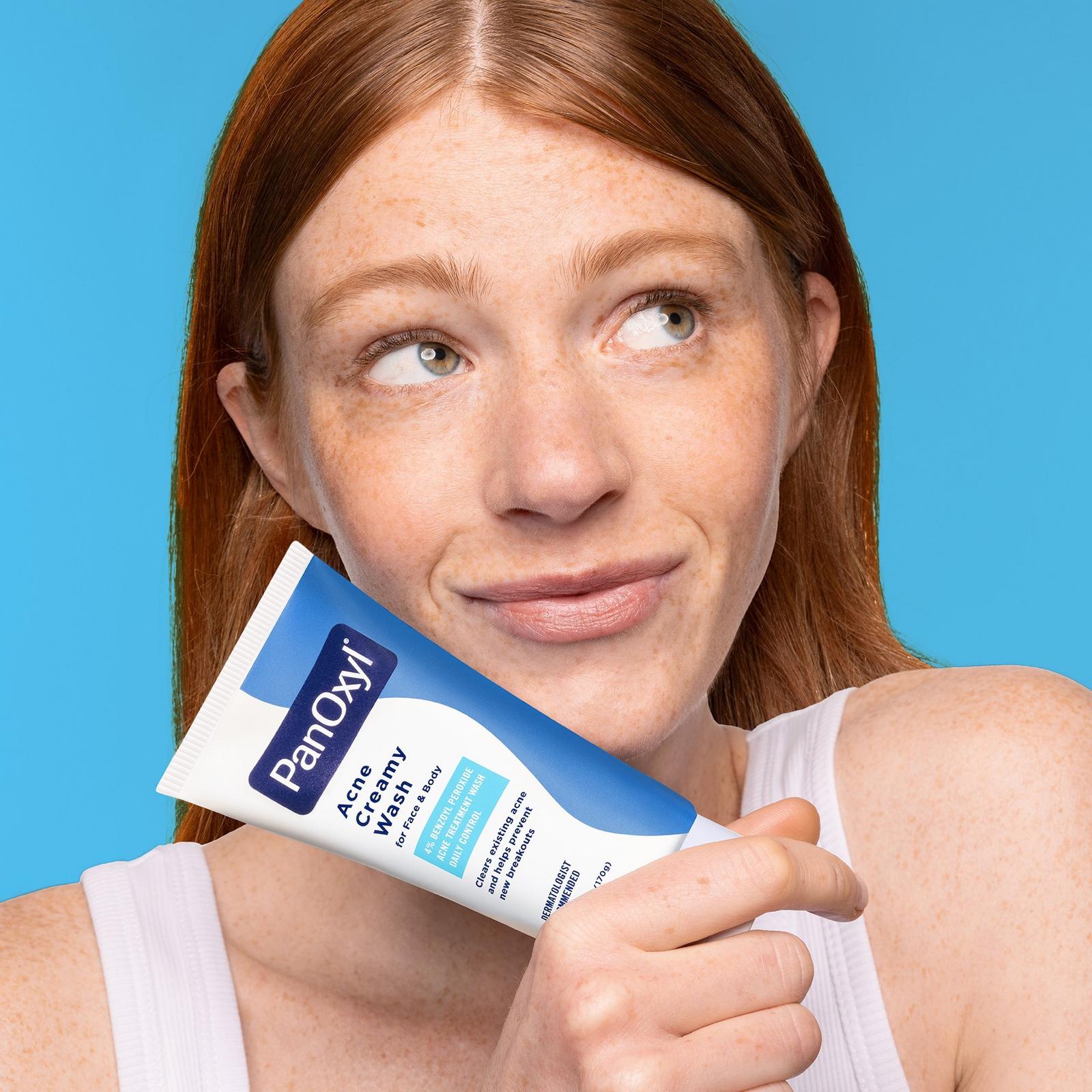 Acne Creamy Wash with 4% Benzoyl Peroxide