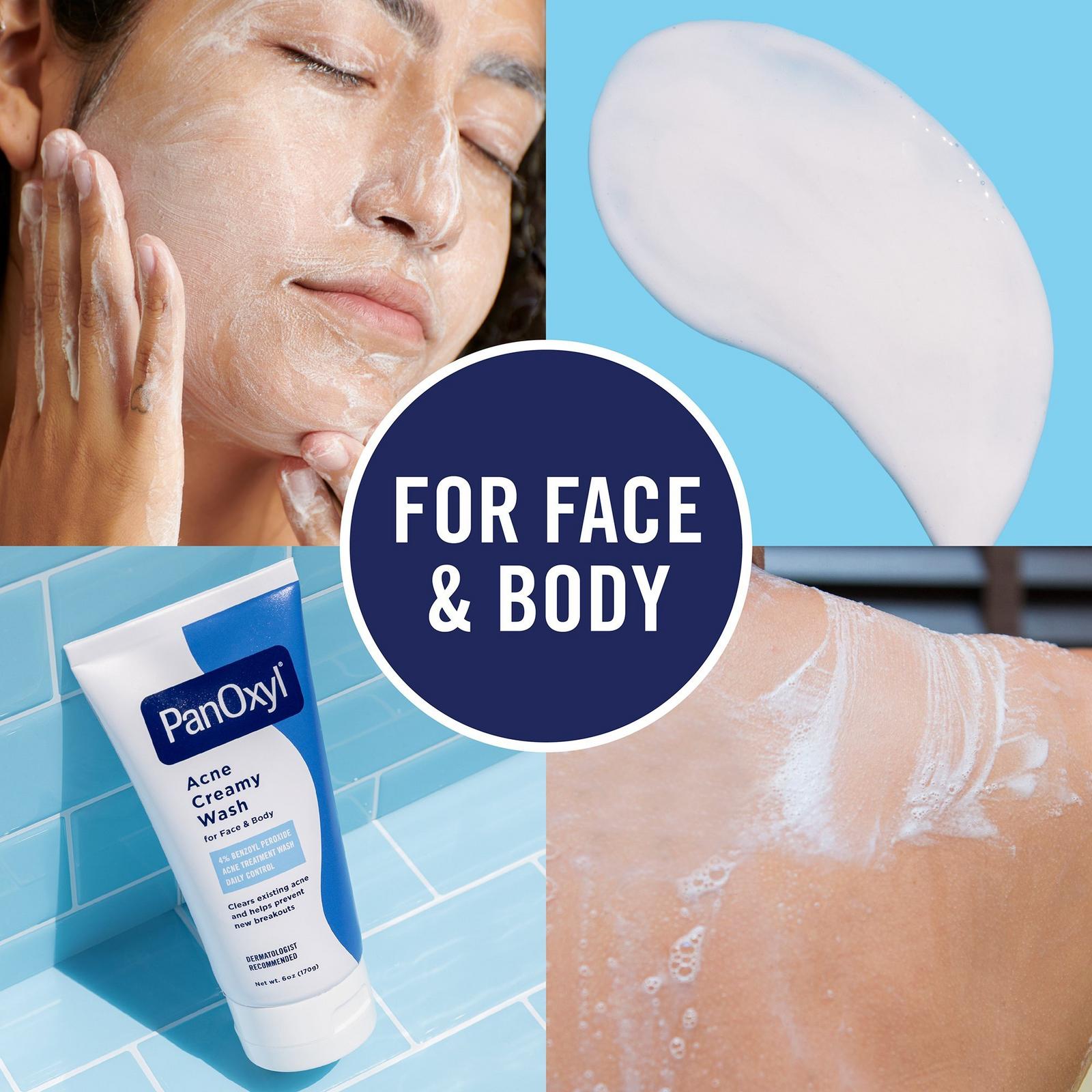 Acne Creamy Wash with 4% Benzoyl Peroxide