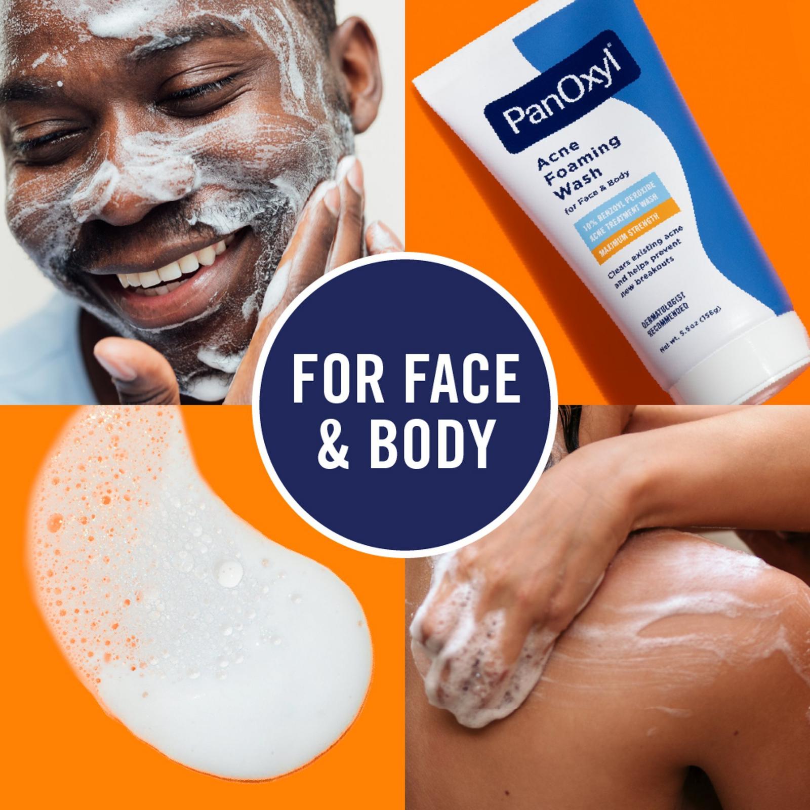 Acne Foaming Wash with 10% Benzoyl Peroxide