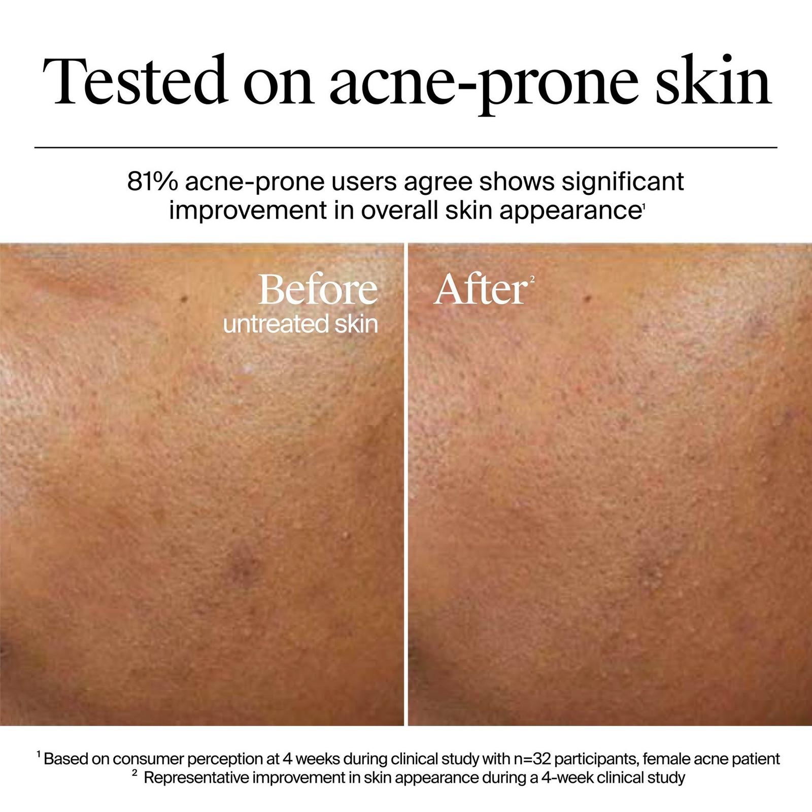 Travel Size Hydro Boost Hyaluronic Acid Water Gel Moisturizer, Fragrance Free