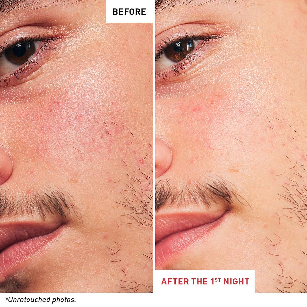 Travel Size Skin Therapy Multi-Perfecting Night Oil-Serum