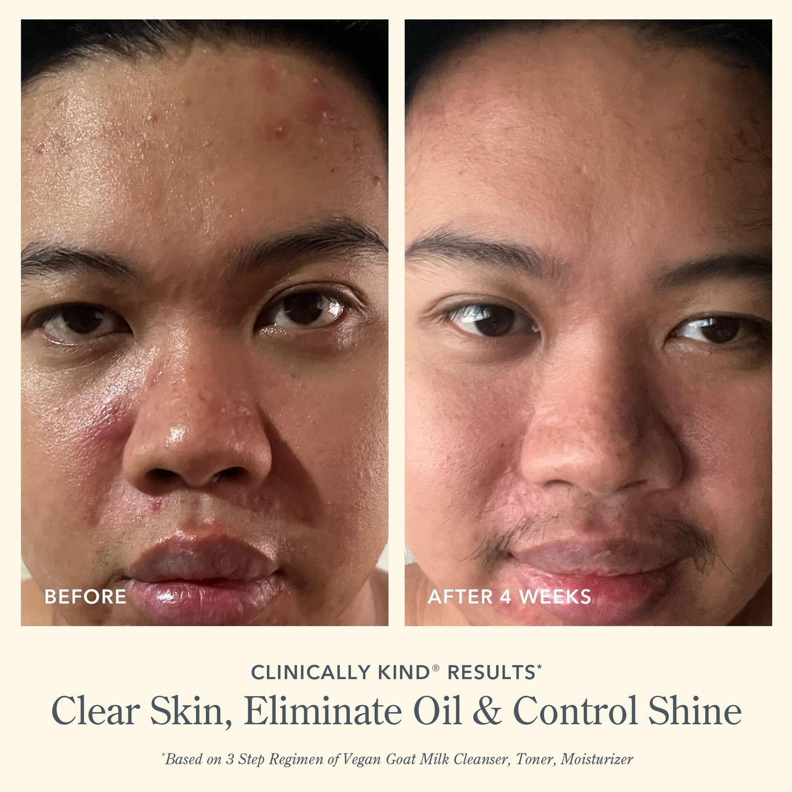 Pore Minimizing Facial Toner