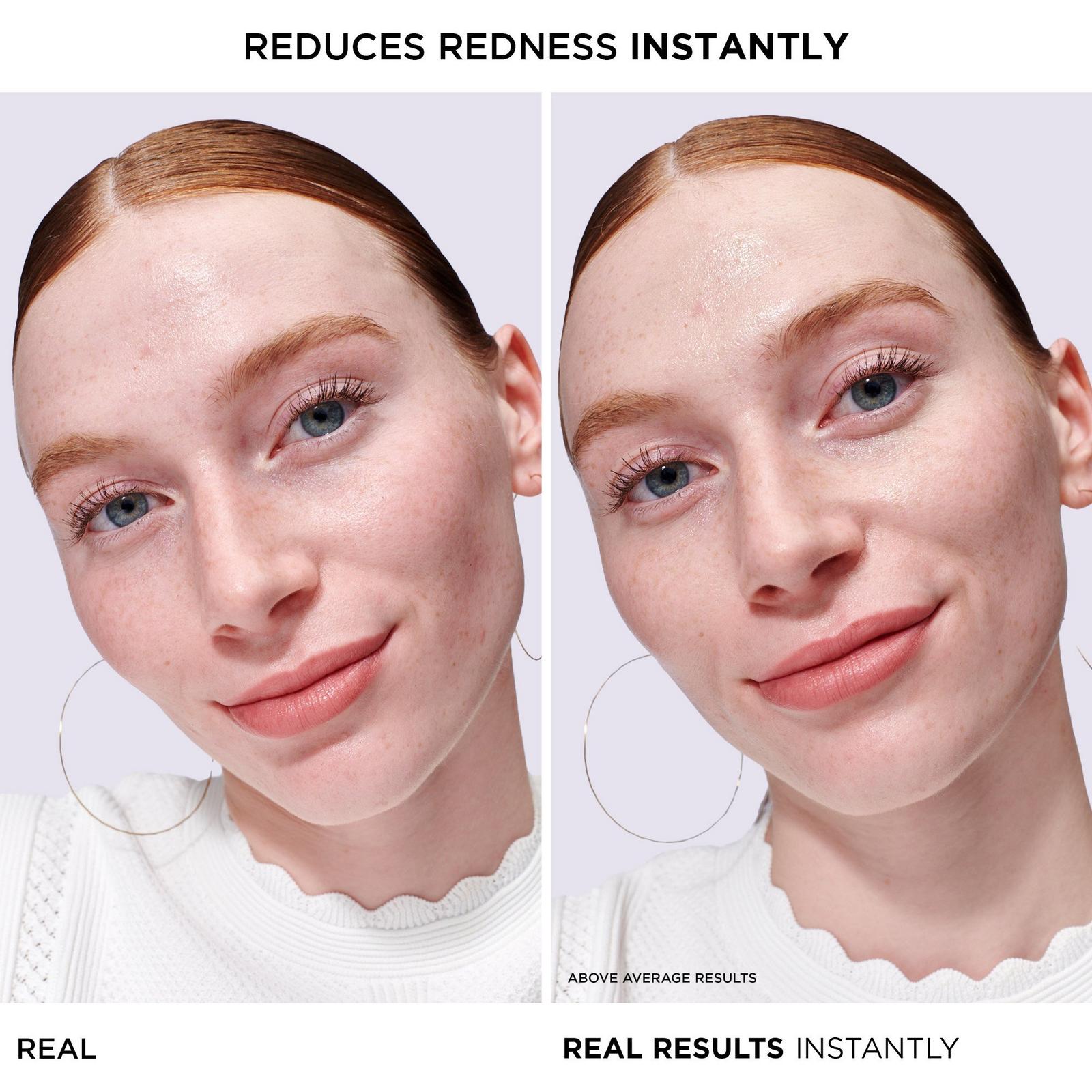 Bye Bye Redness Serum