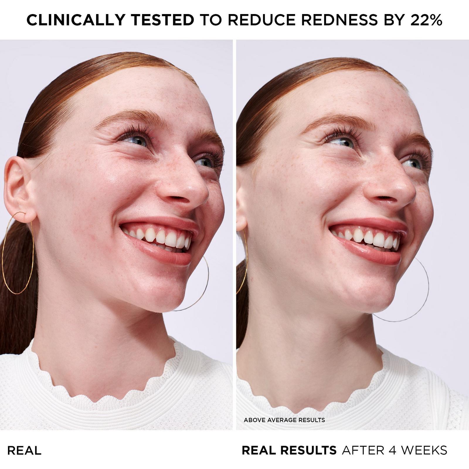 Bye Bye Redness Serum
