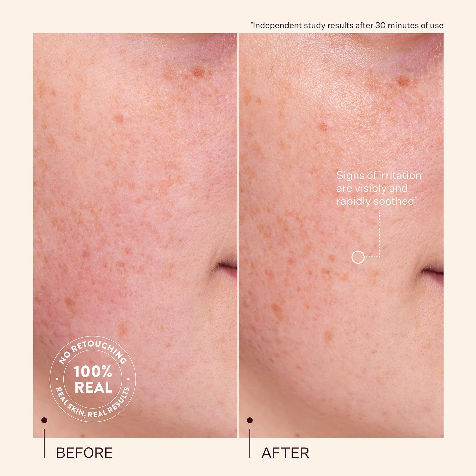 Rescue Party Barrier Restore Serum