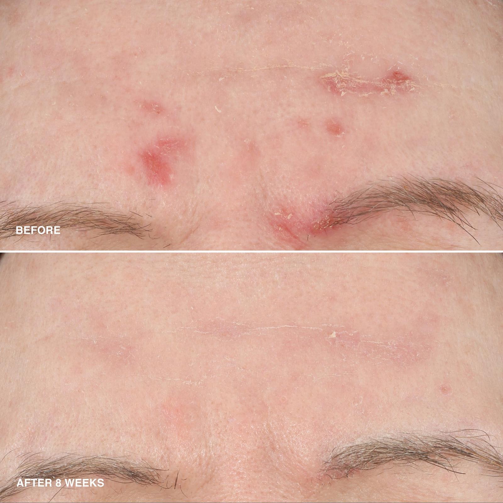 Vitamin Enriched Smoothing Serum with Niacinamide