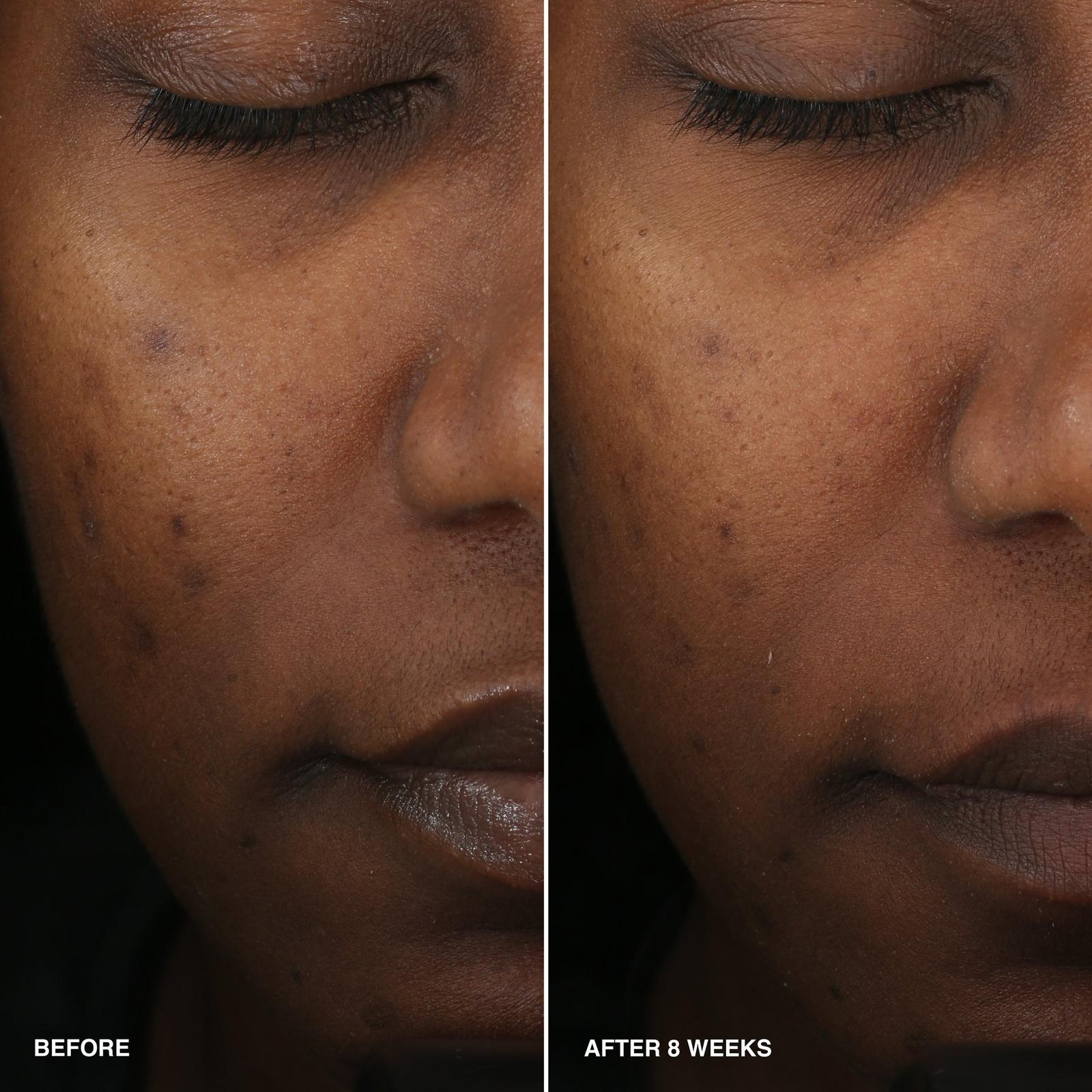 Vitamin Enriched Smoothing Serum with Niacinamide