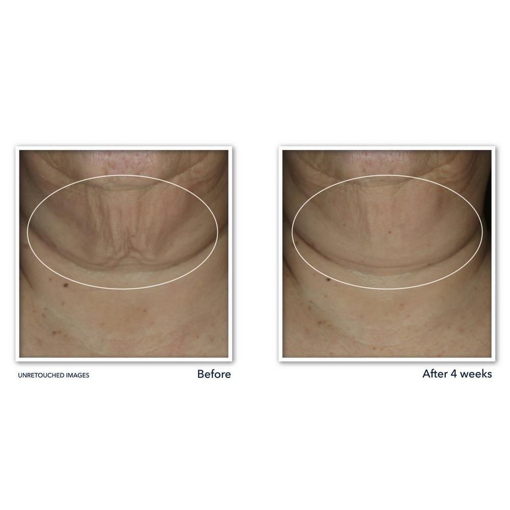 Derm Correxion Firming Serum Stick