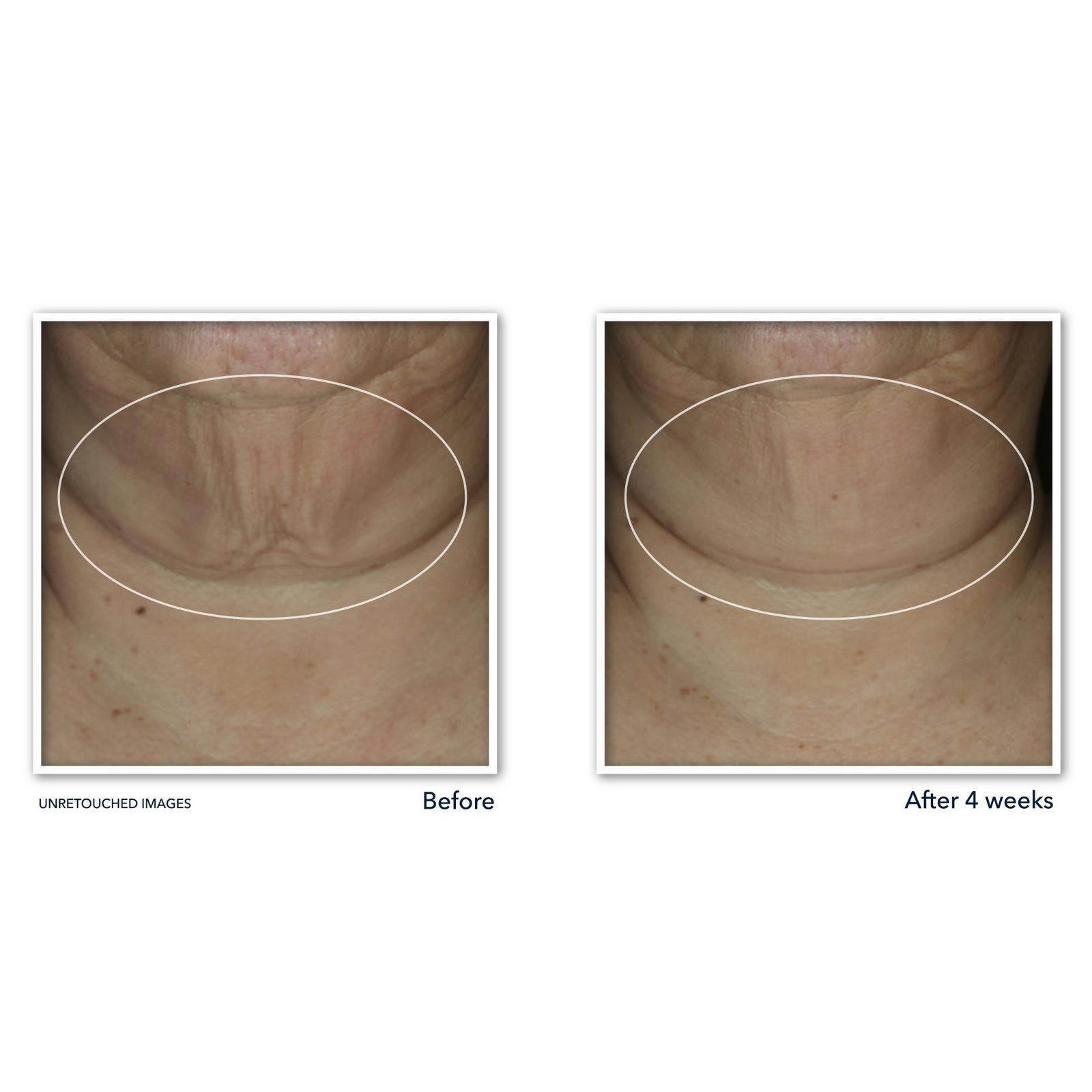 Derm Correxion Firming Serum Stick