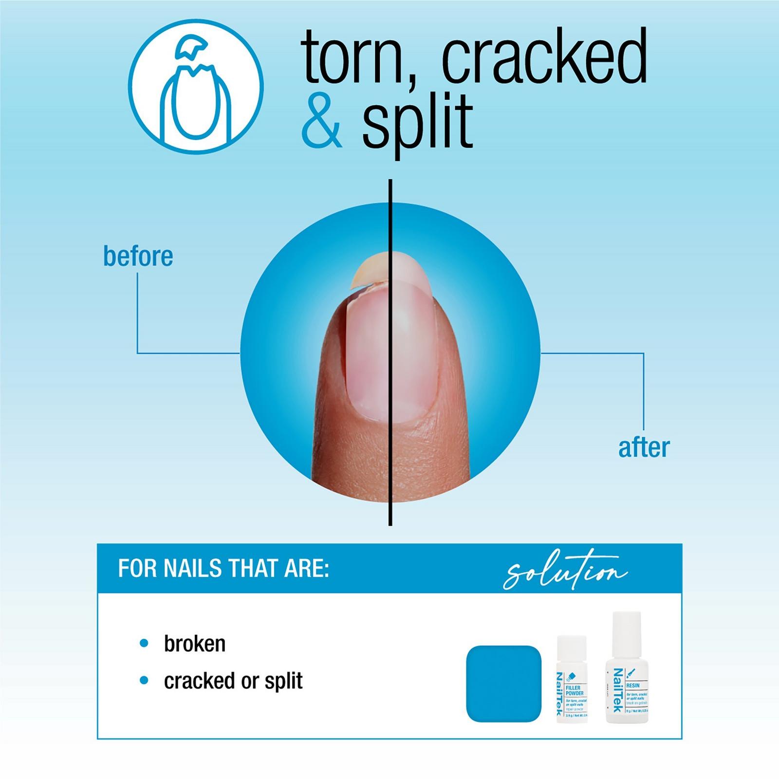 Nail Repair System - Torn, Cracked, Split Nails