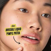 Truly Targeted Acne-Clearing Solution with Salicylic Acid