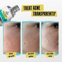 Kiehl's Since 1851 Truly Targeted Acne-Clearing Solution with Salicylic Acid #6