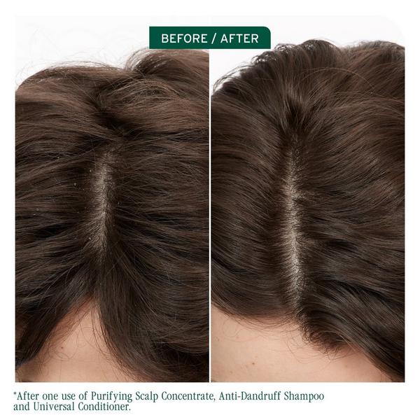 Biolage Scalp Sync Anti-Dandruff Shampoo #6