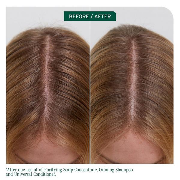 Biolage Scalp Sync Calming Shampoo for Dry Sensitive Scalp #6