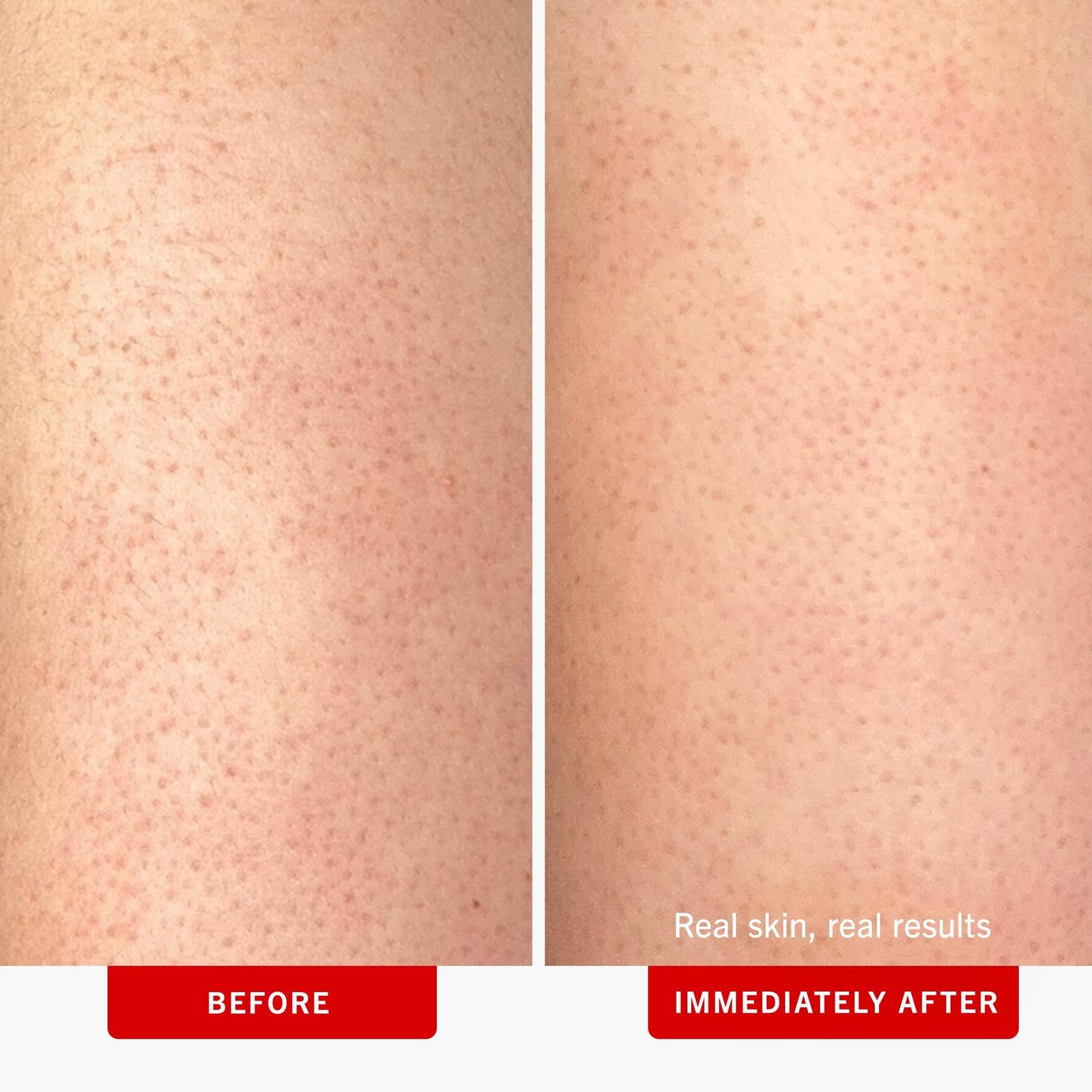 KP Bump Eraser Body Scrub Fresh Strawberry