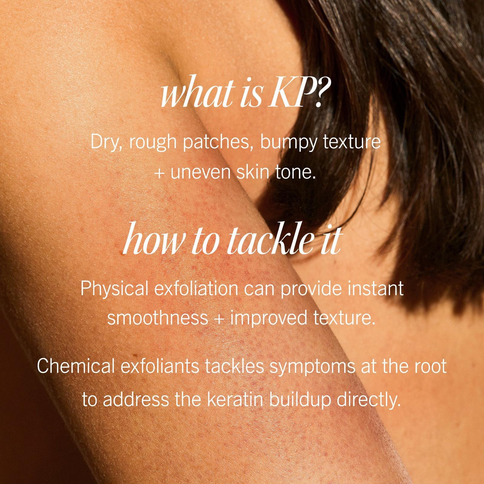 KP Bump Eraser Body Scrub Fresh Strawberry