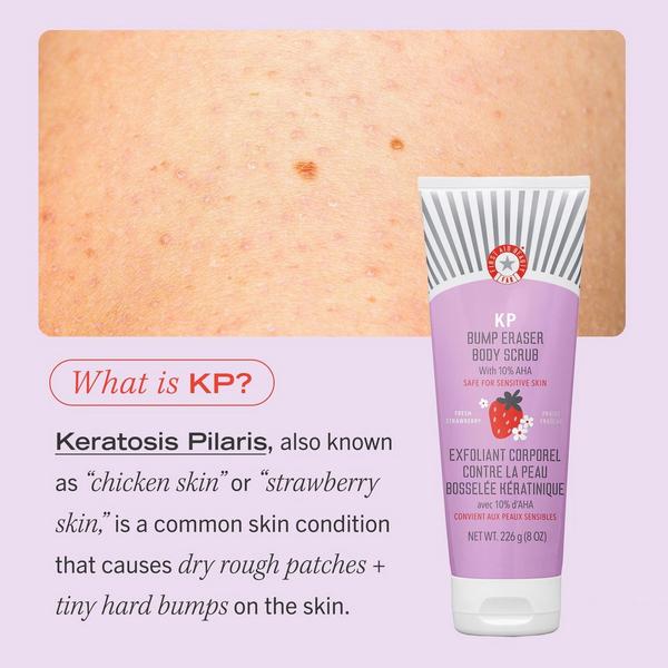 First Aid Beauty KP Bump Eraser Body Scrub Fresh Strawberry #6