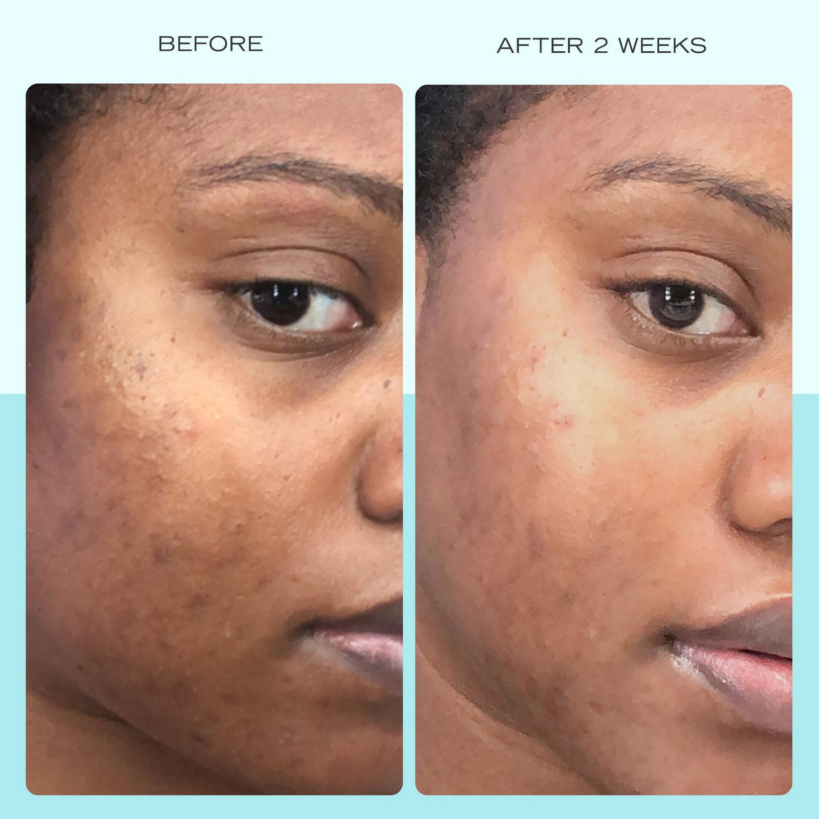Facial Radiance Niacinamide Dark Spot Serum