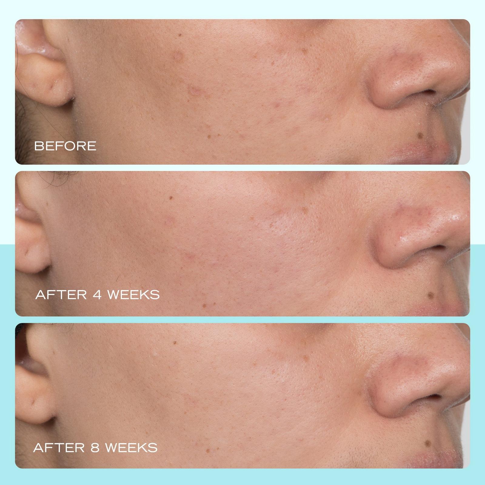 Facial Radiance Niacinamide Dark Spot Serum