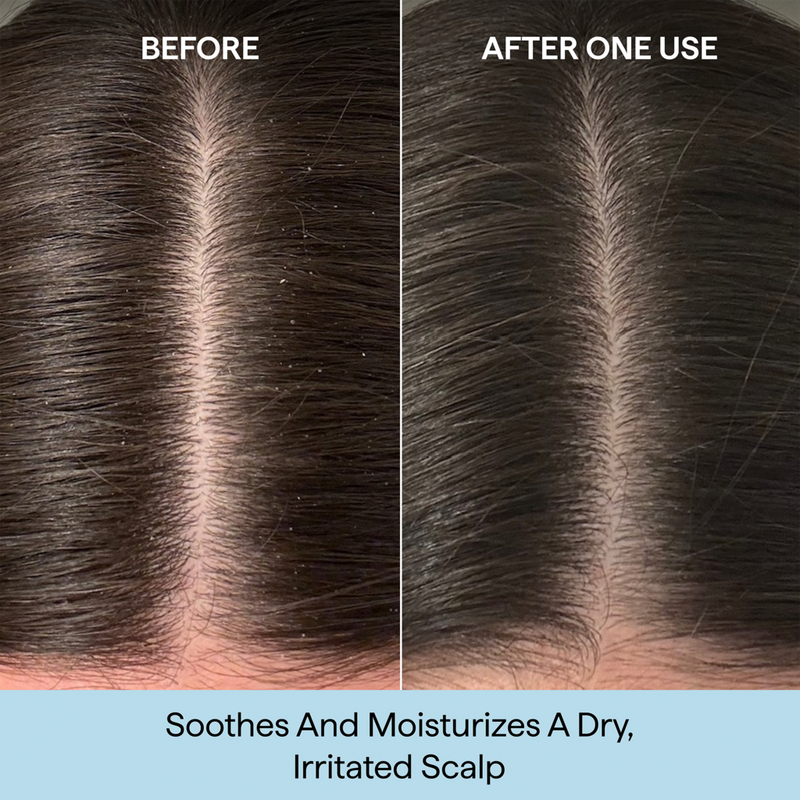 Briogeo - 3.4 oz Scalp Revival Rosemary Pre-Wash Oil | Ulta Beauty