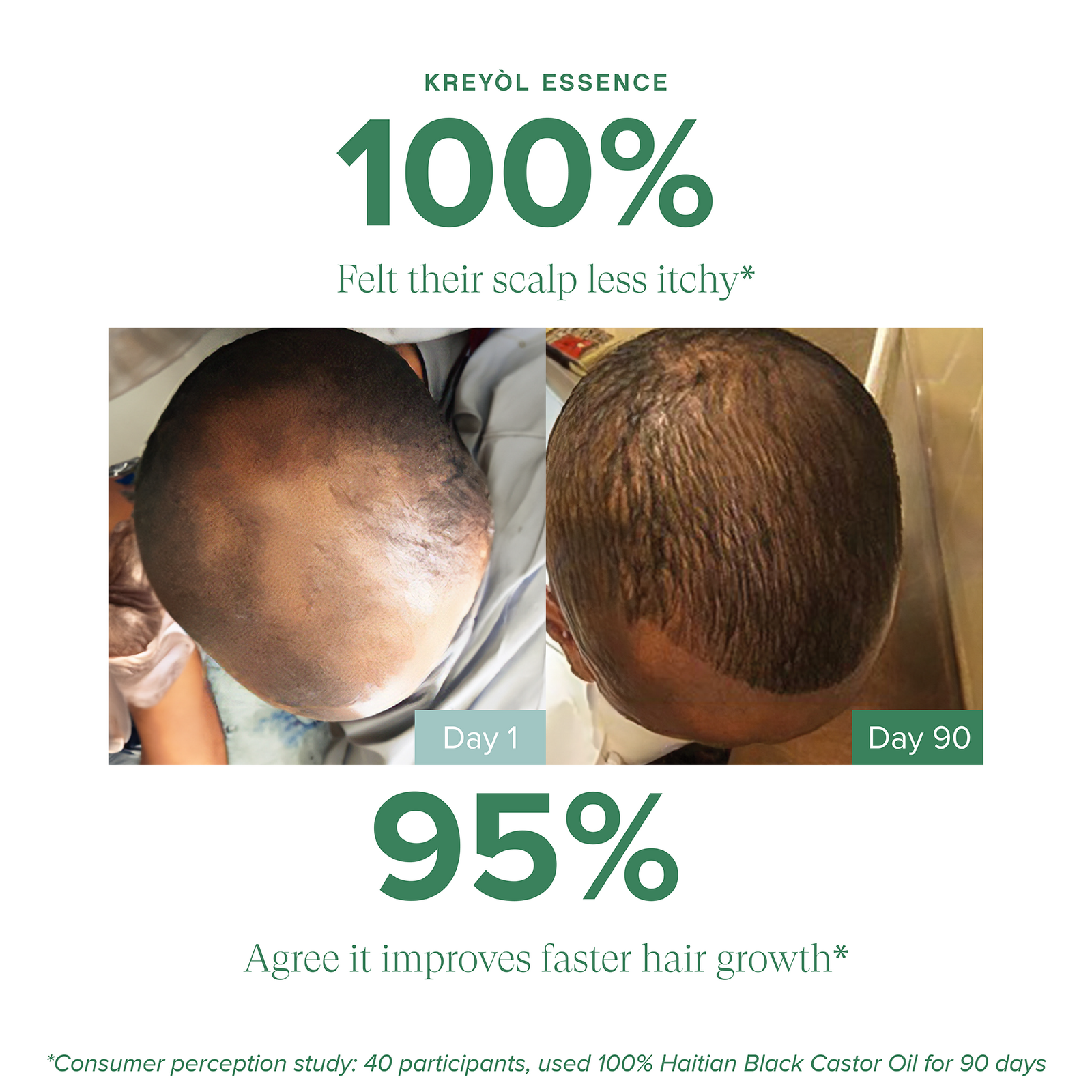 Save Our Scalp Serum S.O.S Serum