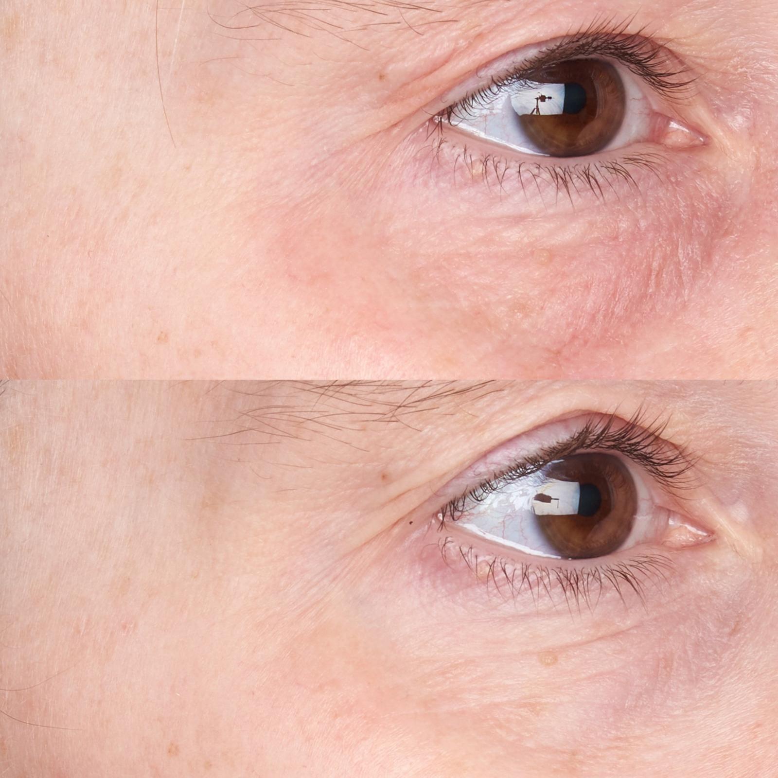 Cold Plasma Plus+ Daily Defense Moisturizer Broad Spectrum SPF 35