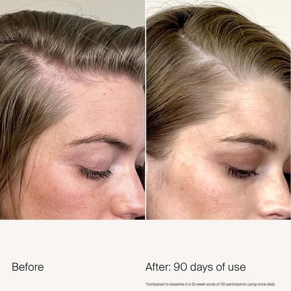 Living Proof Scalp Care Density Serum #5