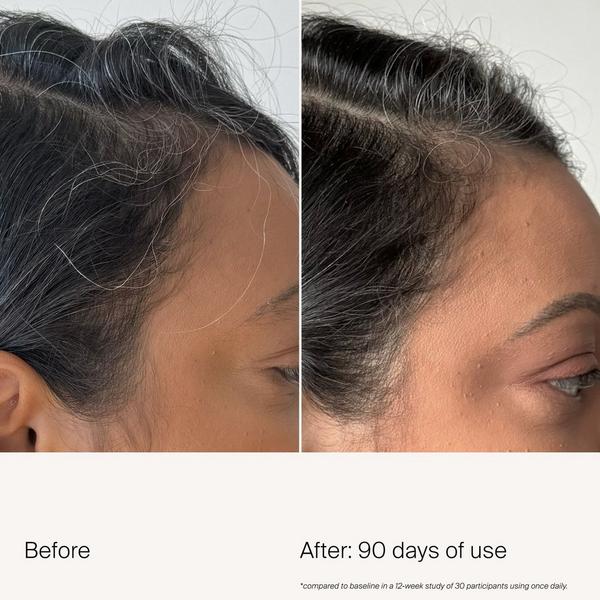 Living Proof Scalp Care Density Serum #6