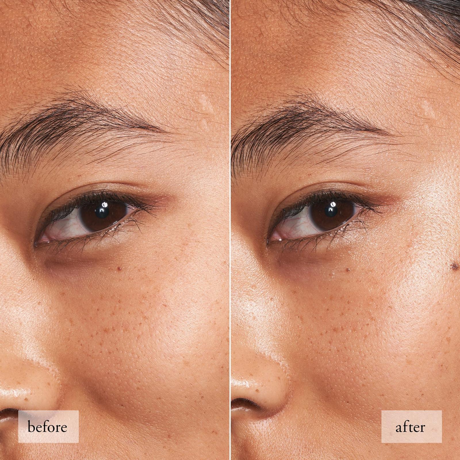 Dose Of Wisdom Dark Circle Brightening Eye Cream