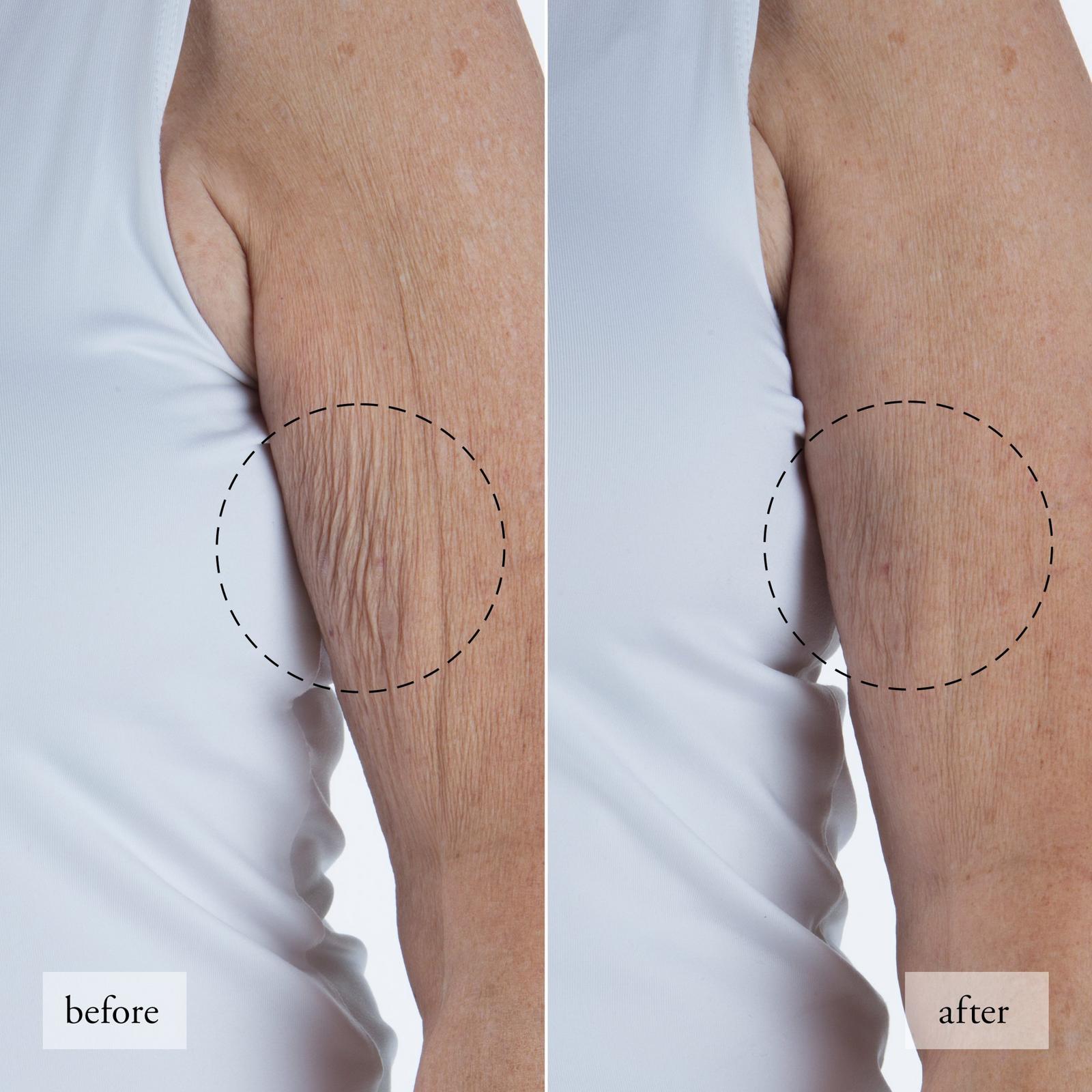 Ultimate Miracle Worker Resurfacing Body Serum