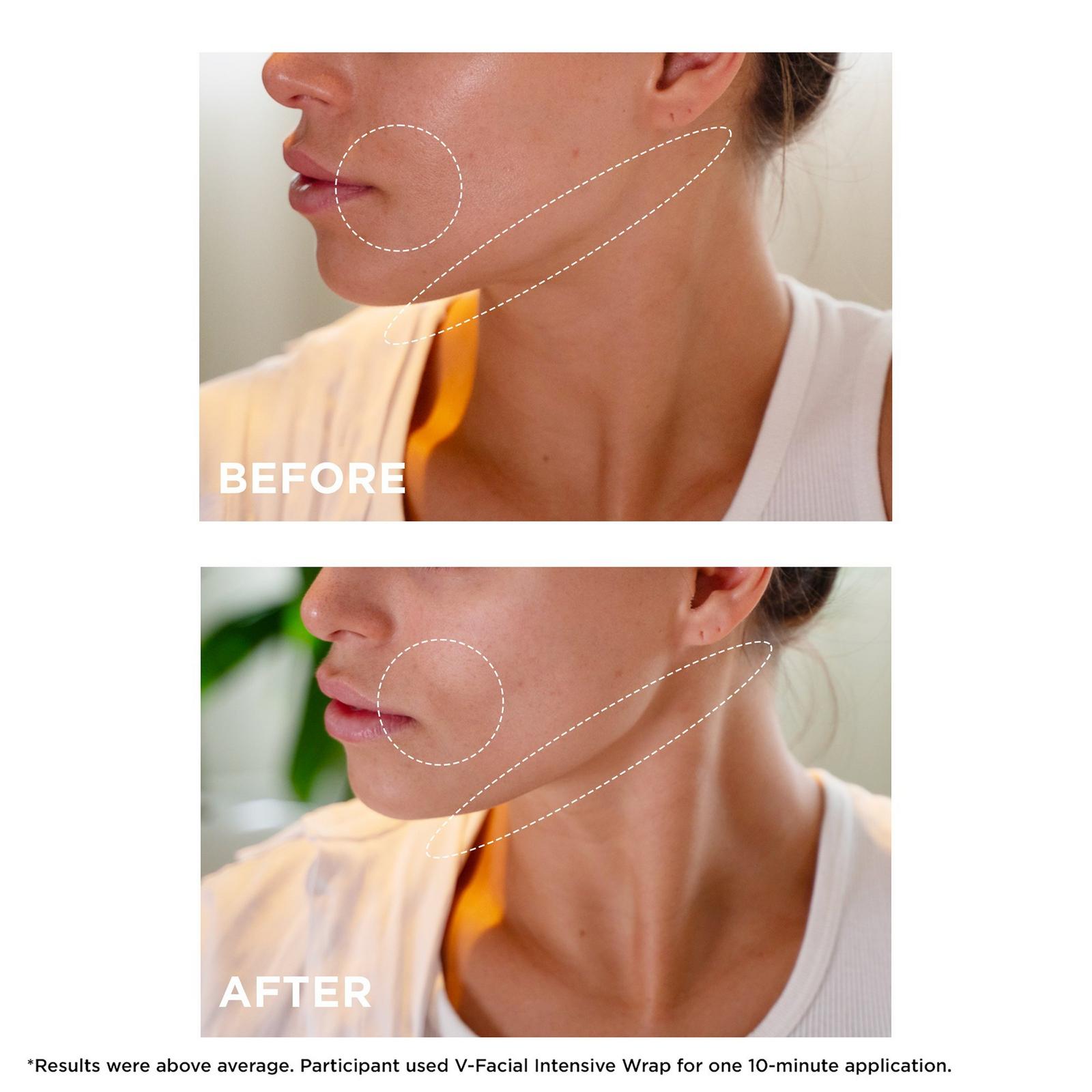 V-Facial Instant Depuffing Face Mask