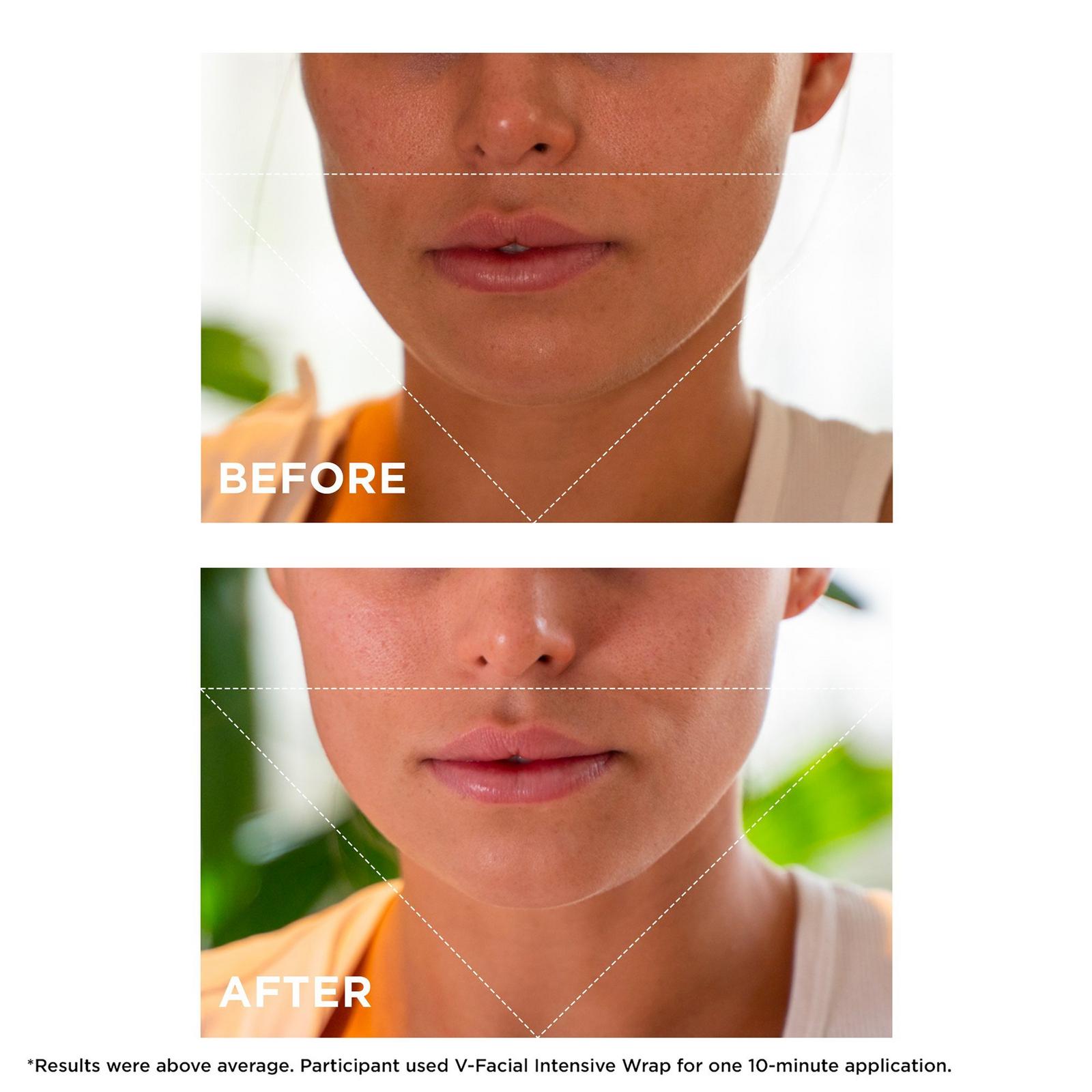 V-Facial Instant Depuffing Face Mask