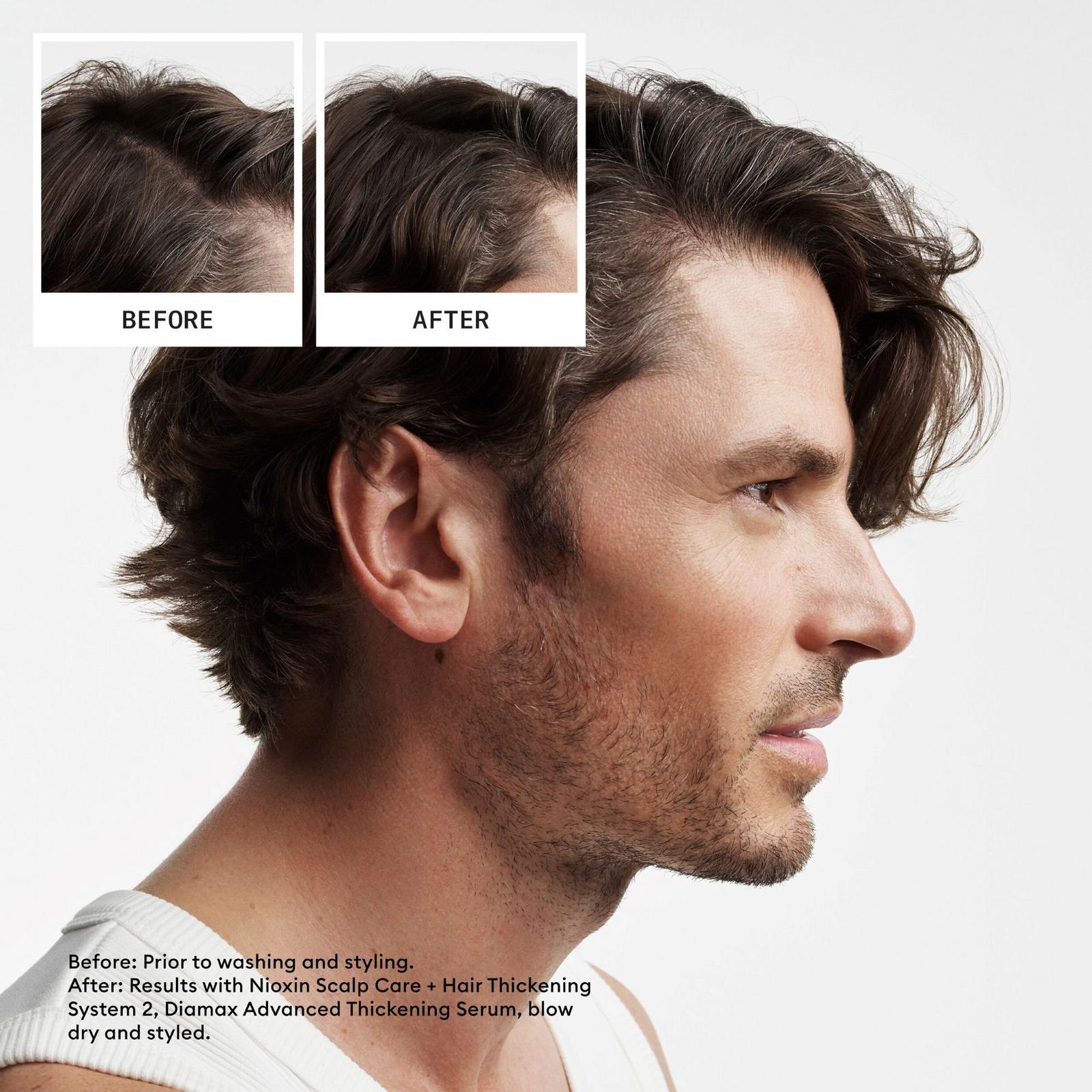 Scalp + Hair Thickening System 2 Conditioner