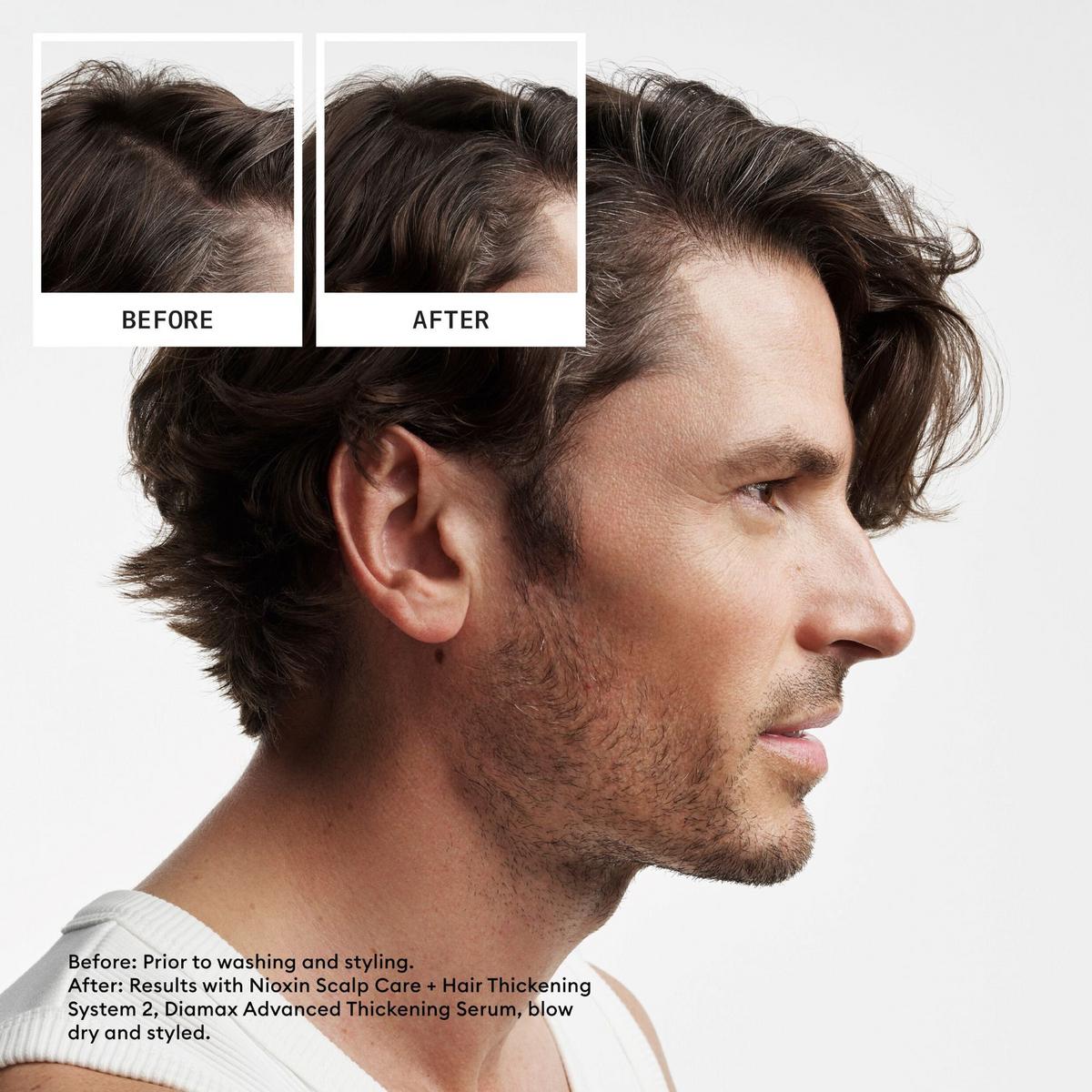 Scalp + Hair Thickening System 2 Shampoo