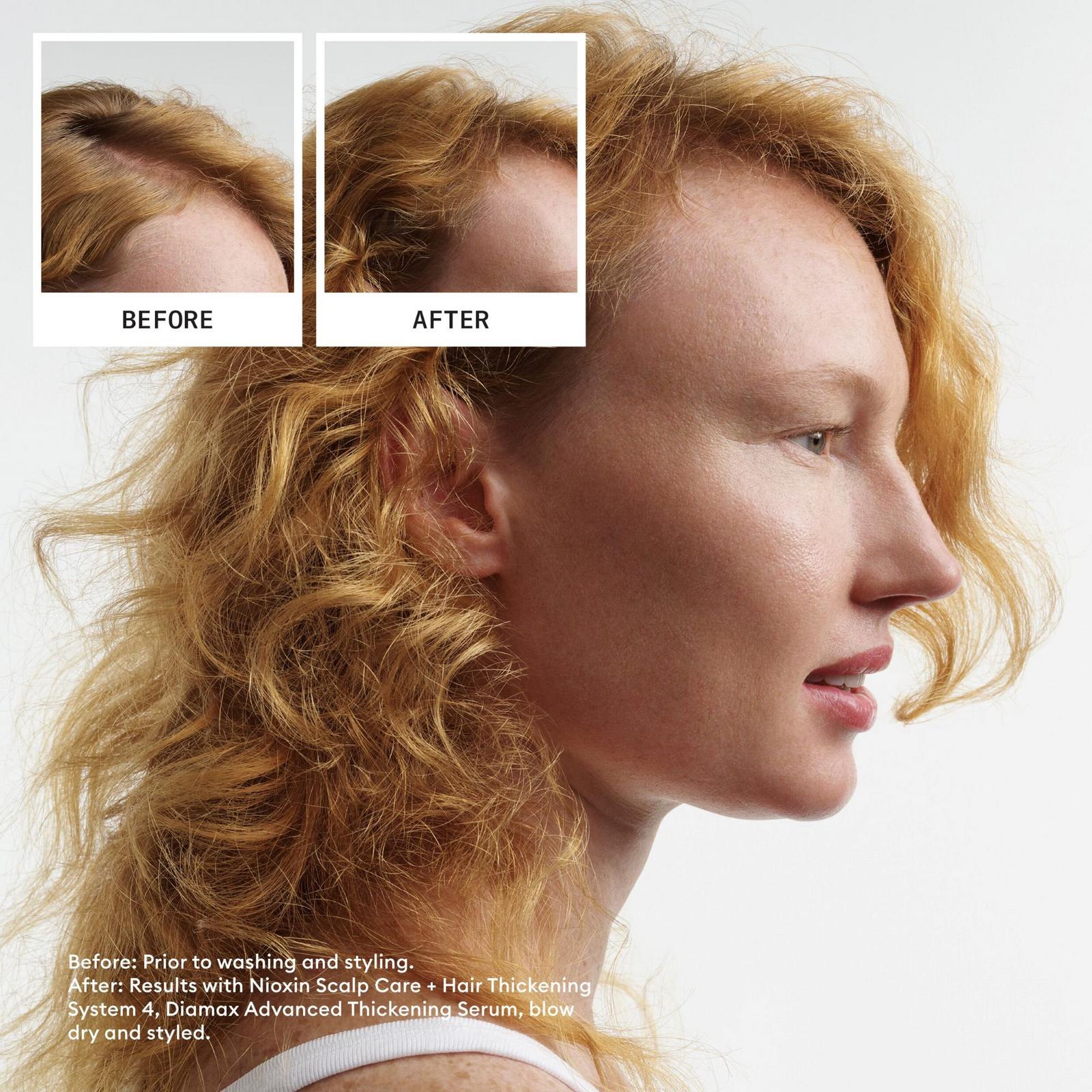 Scalp + Hair Thickening System 4 Kit