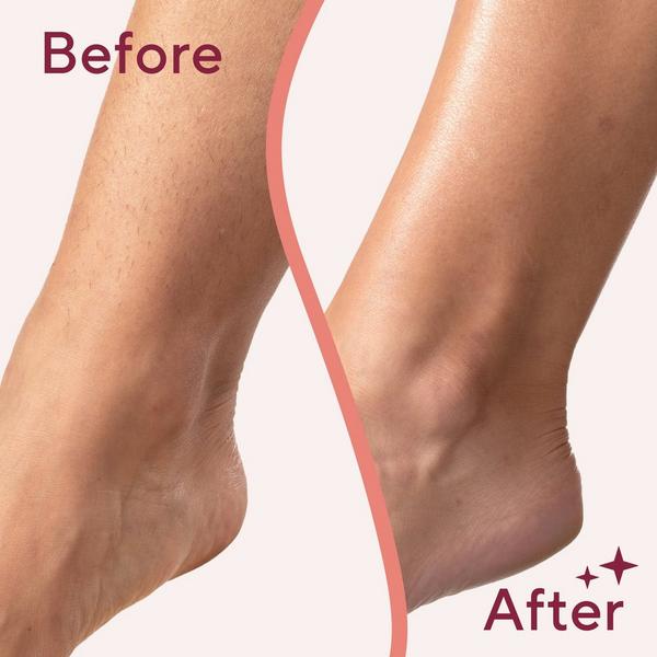 Flawless by Finishing Touch Flawless Legs Electric Razor #4