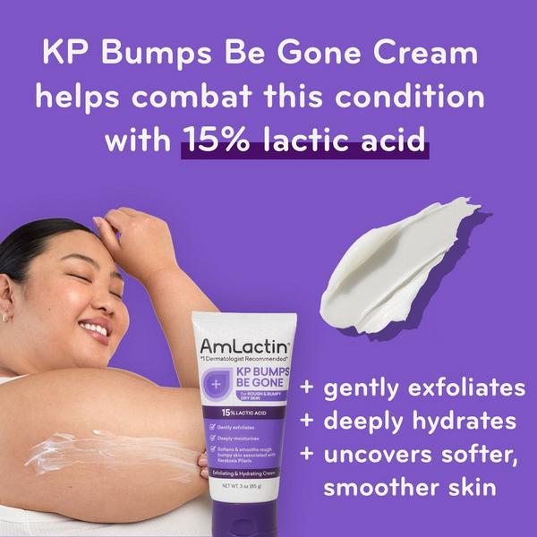 AmLactin KP Bumps Be Gone Cream with 15% Lactic Acid AHA #5