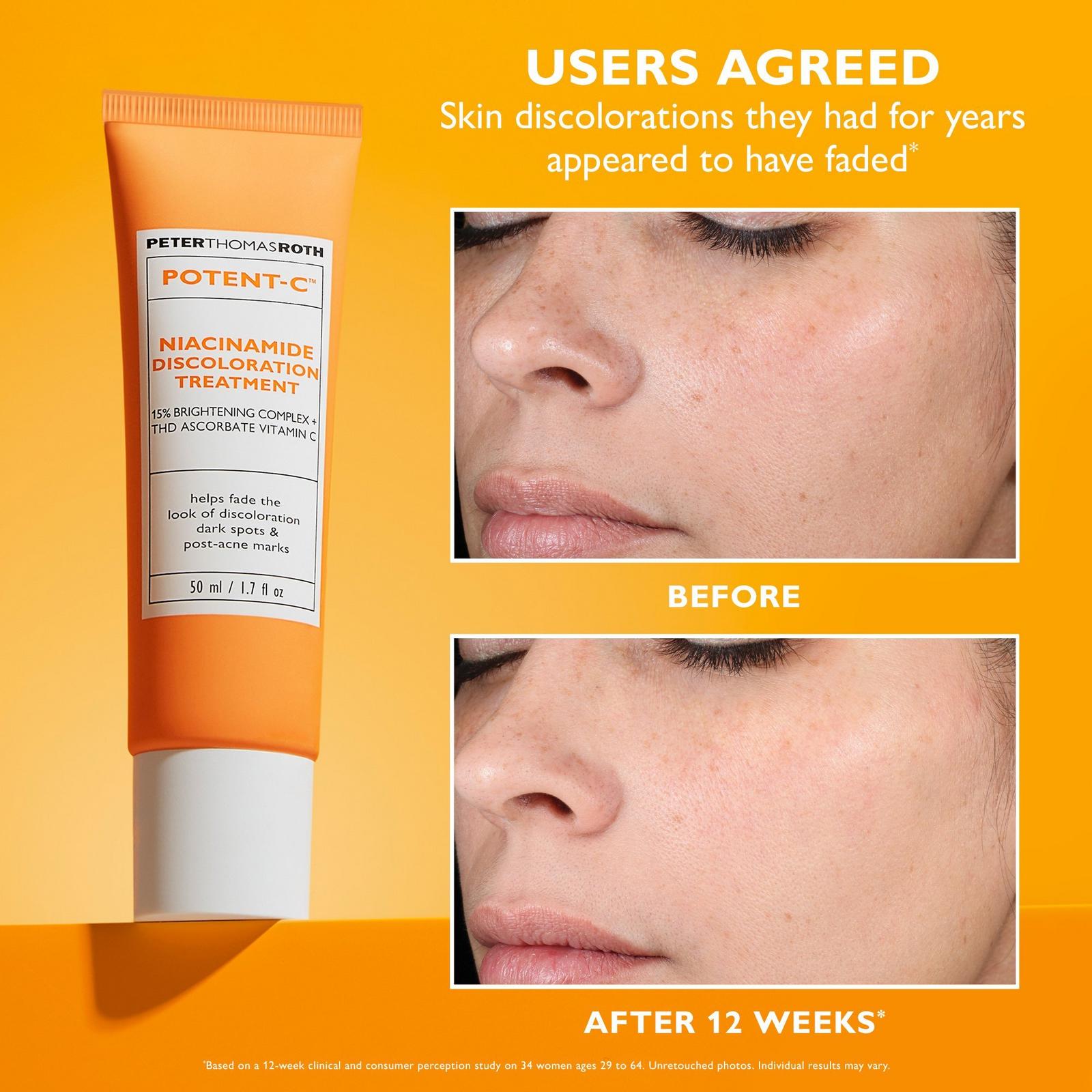 Potent-C Niacinamide Discoloration Treatment