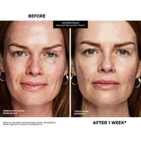 美容液 TAKANO YURI SuperCell Serum 55 Kate Somerville - KateCeuticals SuperCell Rejuvenation Serum