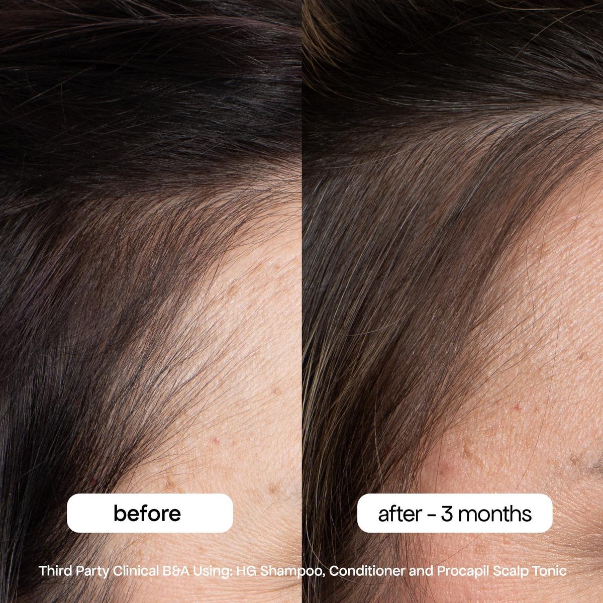 HG Shampoo for Thinning Hair