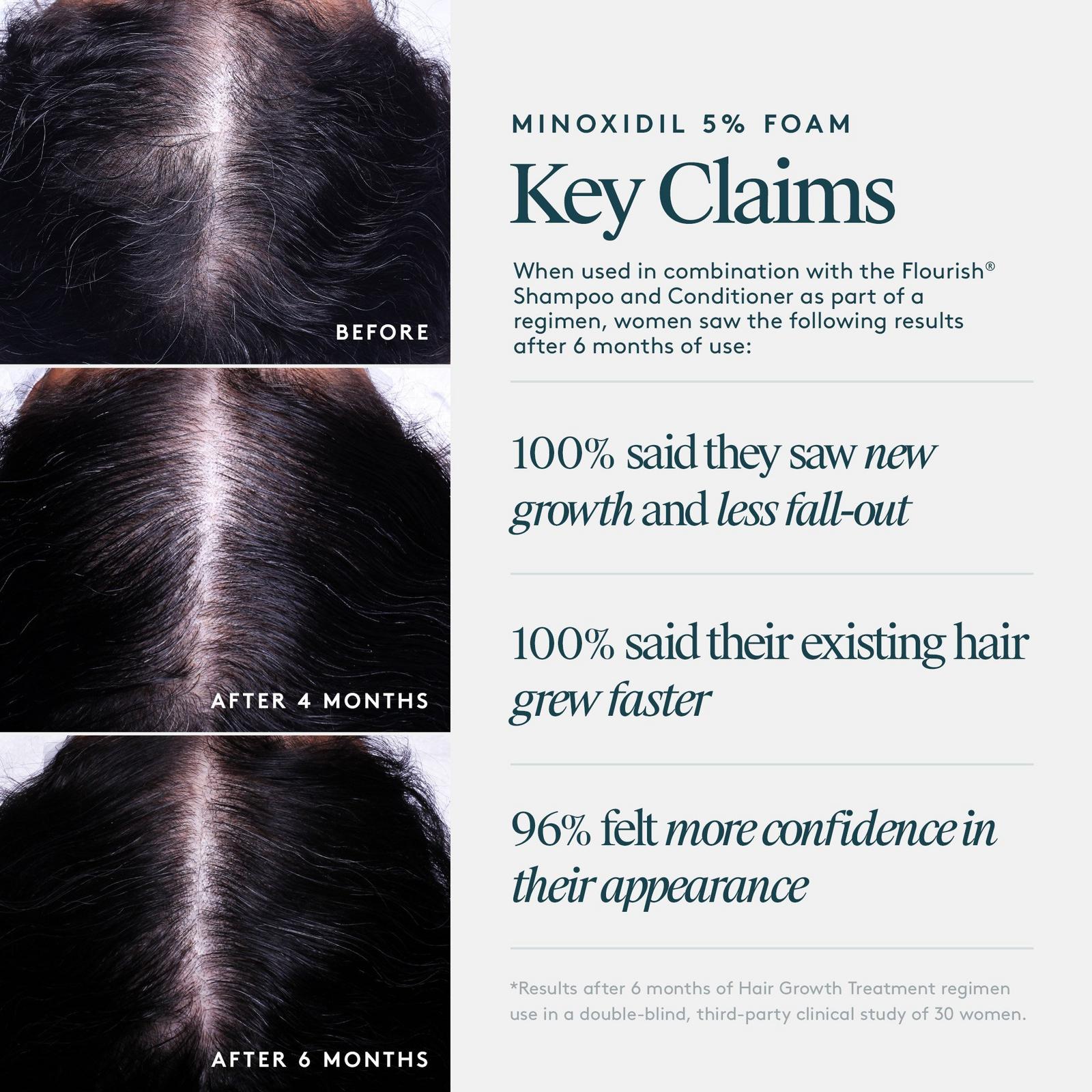 Flourish Minoxidil 5% Foam for Hair Growth