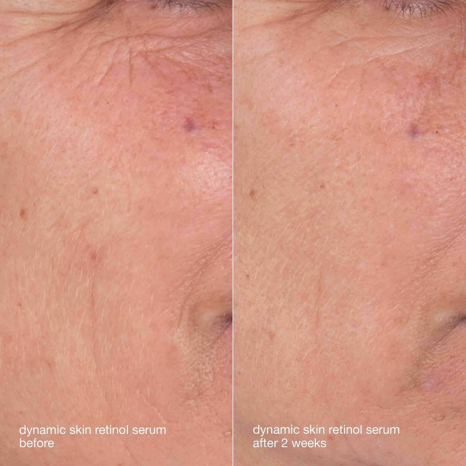 Skin Aging Solutions Skincare Kit